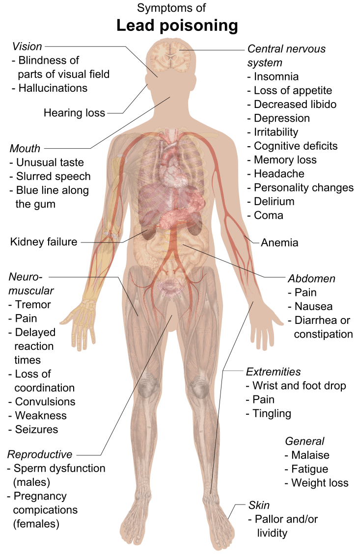 symptoms_of_lead_poisoning_raster